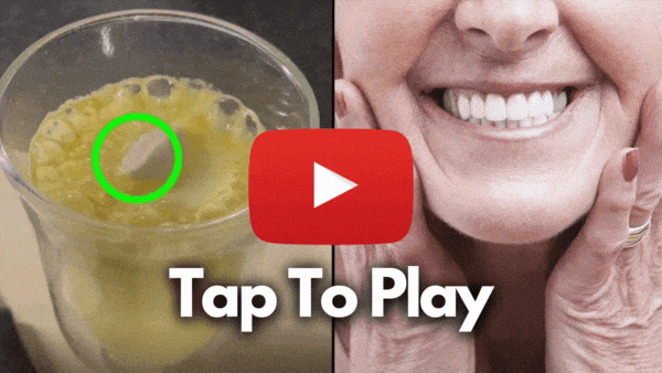 079a20d4-2c52-11ec-bf38-0697e5ca793e_21b731a4652f7377bd552d96d5ccbb8071fdfac9_dental-tweak-creative-tap